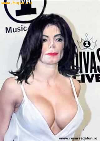 Celebritati - Viitoarea operatie a lui Michael Jackson