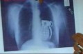 Diverse - Radiografia unui terorist